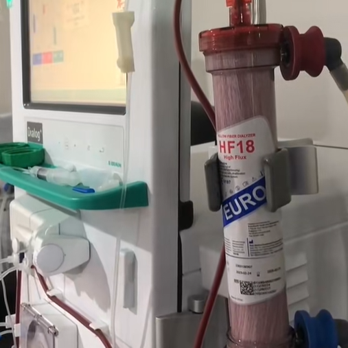 Dialysis machine